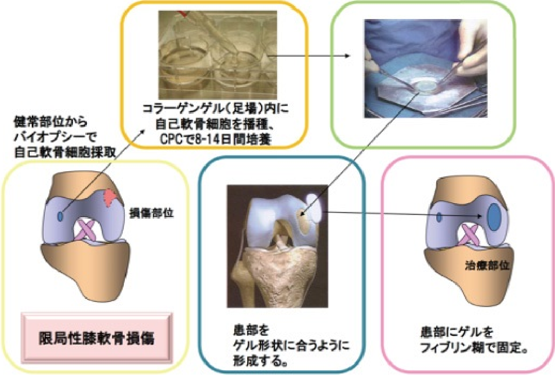IK-01による膝軟骨の治療戦略