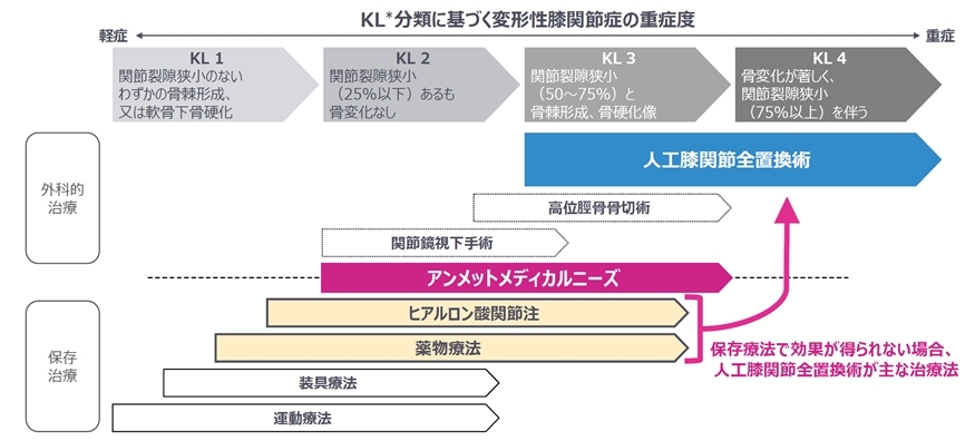 KL*分類に基づく変形性膝関節症の重症度
