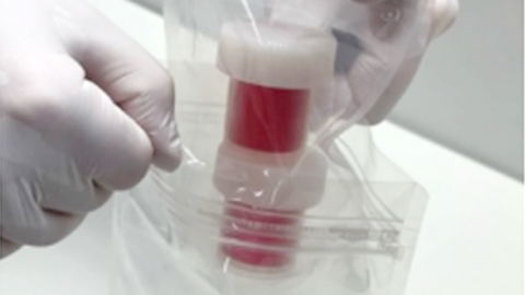 Oral mucosal tissue transport set