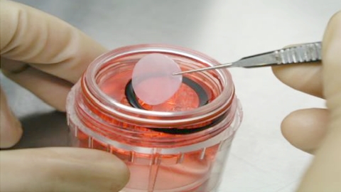 Cultured autologous oral mucosal epithelial cell sheet package