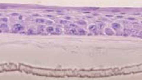 H&E staining image of multiple layers of oral mucosal epithelial cells on an amniotic membrane substrate